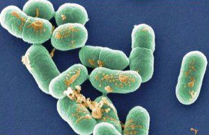 Листерия бактериялары, Листериоз, Бактерии листерии